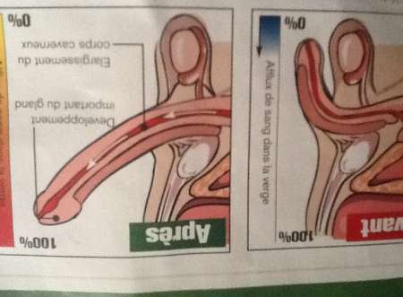 Magnetiseur soigne L érection,L ejaculation precoc