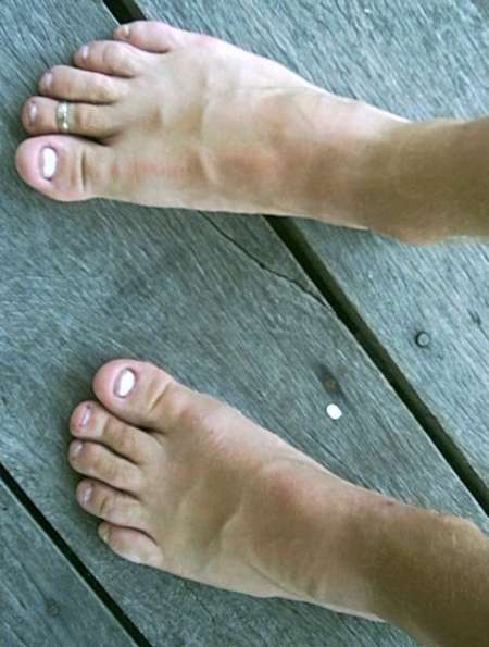  pour Jf aux ongles rong�s