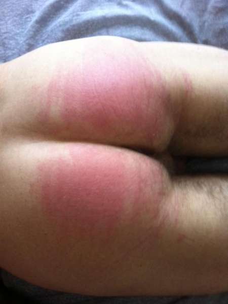 La fess�e � Montpellier