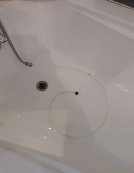 dilatation anale avec lavements